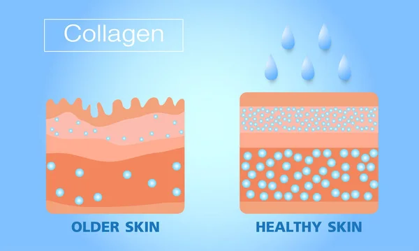 Colágeno, Piel vieja y piel dura, Protección de la piel, vector — Archivo Imágenes Vectoriales