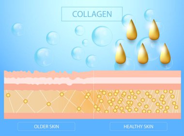 Kolajen, Koruma Cildi vektör tasarımı