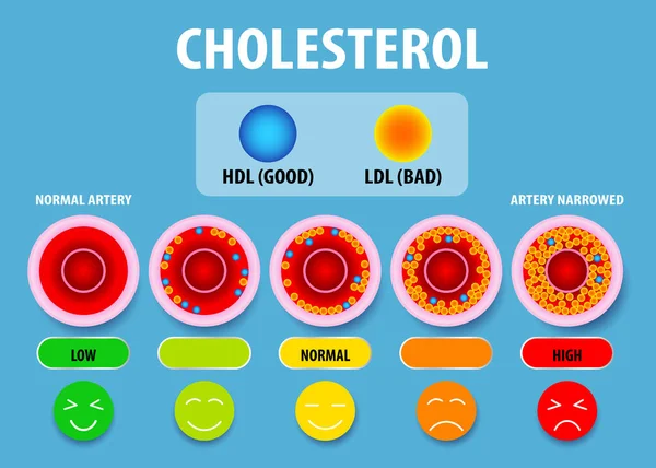 Colesterol Artéria Risco Para Saúde Desenho Vetorial — Vetor de Stock