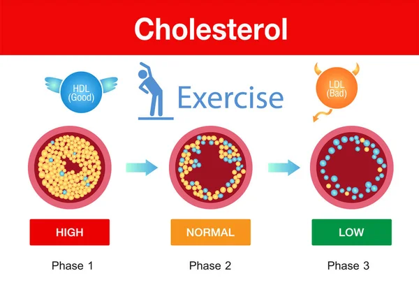Colesterol Arteria Riesgo Para Salud Ejercicio Diseño Vectores — Vector de stock