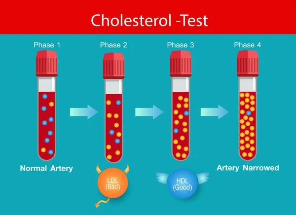 Colesterol Artéria Risco Para Saúde Níveis Colesterol Desenho Vetorial — Vetor de Stock