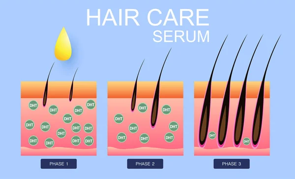 Sérum Péče Vlasy Transplantace Vlasů Vektorový Design — Stockový vektor