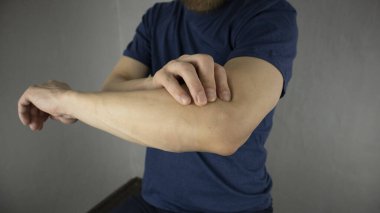 Bir adam dirsek eklemine masaj yapar.