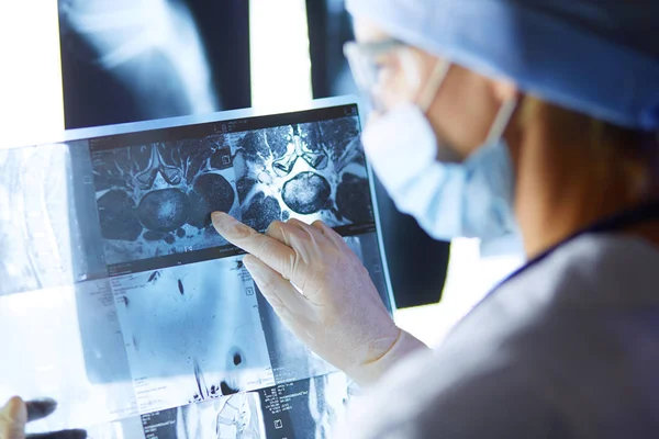 Zwei Ärztinnen betrachten Röntgenbilder in einem Krankenhaus. — Stockfoto