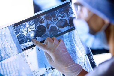 Hastanede röntgen çektiren iki kadın doktor..