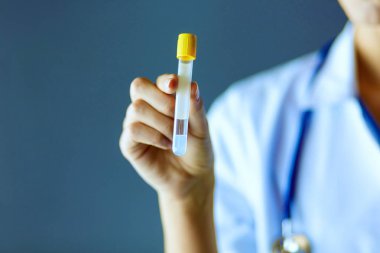 Laboratuvarda ya da laboratuvarda test tüpüne bakarak kadın tıbbi ya da araştırma uzmanı ya da doktor.