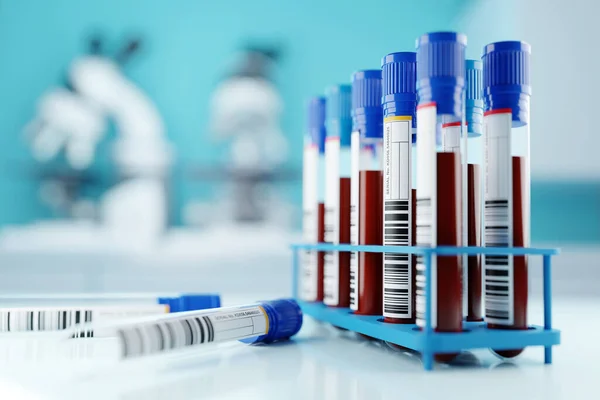 Uma fileira de amostras de sangue humano em um laboratório médico — Fotografia de Stock
