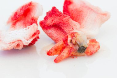 Beyaz arka plan üzerinde kanlı gazlı bez paneliyle çürük diş çıkarma. Sağlık kavramı