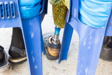 closeup Asya yaşlı kadınla alüminyum protezleri mavi sandalye üzerinde