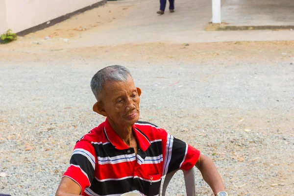 CHIANG RAI, THAILAND - MARÇO 20: não identificado velho asiático lepra homem com humor triste em Março 20, 2016 em Chiang rai, Tailândia . — Fotografia de Stock