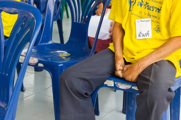 CHIANG RAI, THAILAND - FEVEREIRO 19: Não identificado asiático pessoas que sofrem de lepra em conferência em fevereiro 19, 2016 em Chiang rai, Tailândia . — Fotografia de Stock