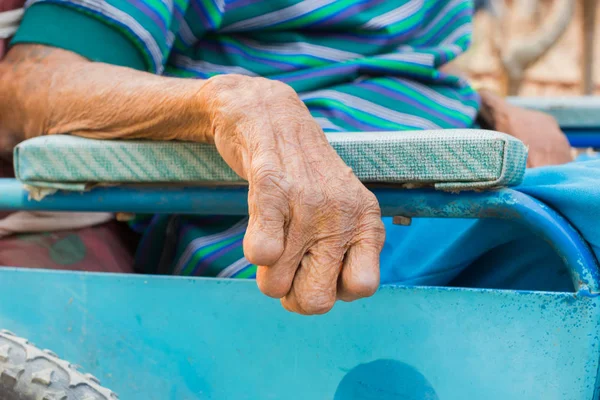 Closeup rukou starého člověka, který trpí z malomocenství, amputovat ruku, na invalidní vozík — Stock fotografie