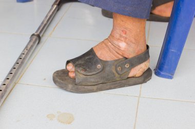 Asya ihtiyar cüzzam yere bastonla acı metrelik portre