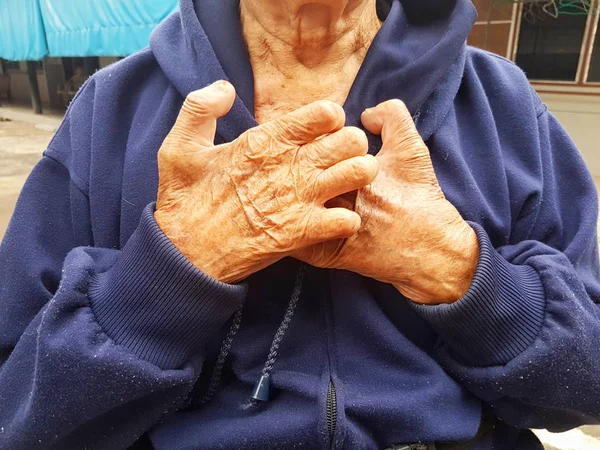 Primer plano manos de asiático discapacitado viejo en su pecho. Concepto de salud . —  Fotos de Stock