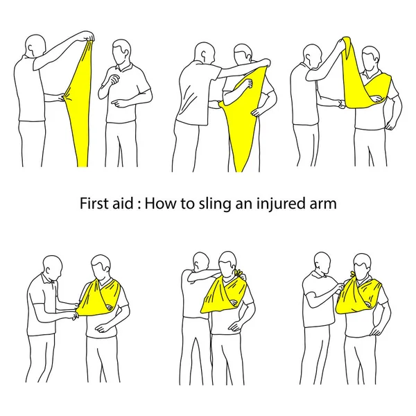 Cómo cabestrillo un brazo lesionado ilustración esquema bosquejo mano dibujada con líneas negras aisladas sobre fondo blanco — Vector de stock