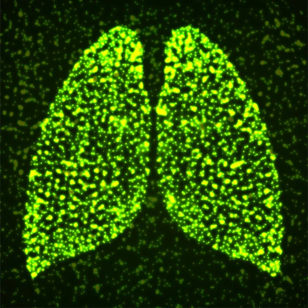 光る粒子の抽象的な人間の肺。ベクトル — ストックベクタ