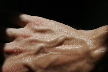 Siyah arka planda bir sürü damarı olan terli bir elin sırtı.