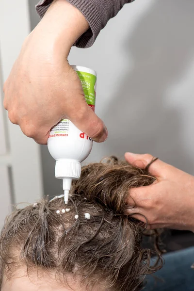 Lice çocuk üzerinde karşı tedavi