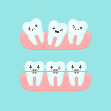 Diş teli dizilimi stomatoloji konsepti, sevimli renkli diş vektörü çizimi