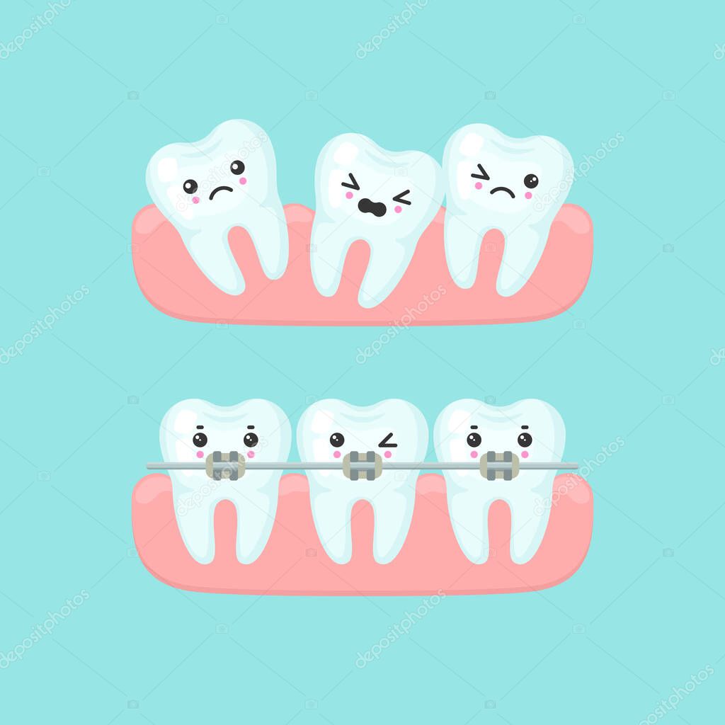 Braces alignment stomatology concept, cute colorful teeth vector illustration