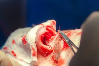 Cerrah ve hastane ameliyathane burnuna estetik ameliyat asistanı. Burnun yeniden şekillendirilmesi, büyütme. Burun estetiği.