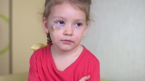 Huiselijk geweld. Triest klein meisje met een blauw oog. Sluit maar af. Angst. — Stockvideo