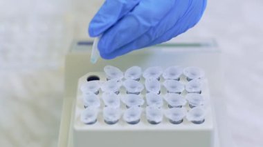 Laboratuvar çalışanı, bir tıbbi laboratuvarda bağışıklık virüsü analizi yapmak için numuneleri bir tepsiye koyar.