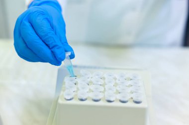 Laboratuvar çalışanı, bir tıbbi laboratuvarda bağışıklık virüsü analizi yapmak için numuneleri bir tepsiye koyar.