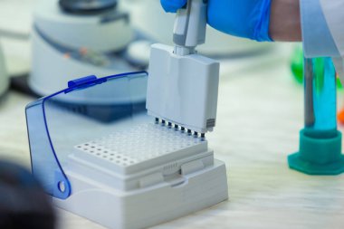 Laboratuvar çalışanı numuneleri bir tıbbi laboratuvarda bağışıklık virüsleri için analiz yapan bir tepsiye koyar. COVID-19. COVID Coronavirüs