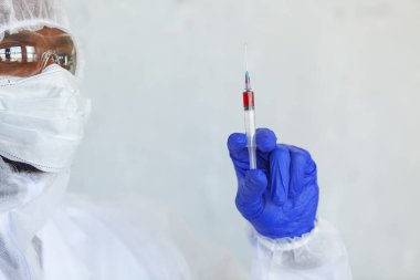 Kimyasal koruma giysisindeki doktor, virüsün salgını ve salgını durdurmak için COVID, COVID-19, Coronavirüs üzerinde test ettiği kan örneğiyle birlikte şırınga tutuyor.