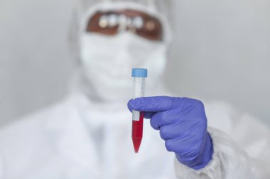 Kimyasal koruma giysisindeki doktor kan örneğini COVID, COVID-19, koronavirüs üzerinde salgını ve salgını durdurmak için test ediyor.