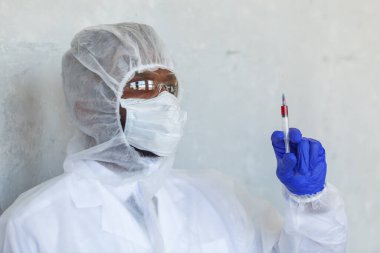 Kimyasal koruma giysisindeki doktor, virüsün salgını ve salgını durdurmak için COVID, COVID-19, Coronavirüs üzerinde test ettiği kan örneğiyle birlikte şırınga tutuyor.