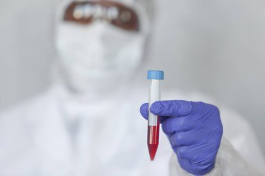 Kimyasal koruma giysisindeki doktor kan örneğini COVID, COVID-19, koronavirüs üzerinde salgını ve salgını durdurmak için test ediyor.