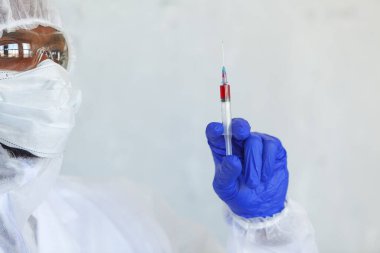 Kimyasal koruma giysisindeki doktor, virüsün salgını ve salgını durdurmak için COVID, COVID-19, Coronavirüs üzerinde test ettiği kan örneğiyle birlikte şırınga tutuyor.
