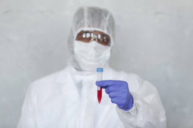 Kimyasal koruma giysisindeki doktor kan örneğini COVID, COVID-19, koronavirüs üzerinde salgını ve salgını durdurmak için test ediyor.