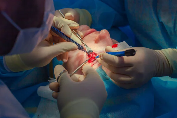 Primer plano de la cara de un paciente que se somete a una blefaroplastia. El cirujano corta el párpado y realiza manipulaciones utilizando instrumentos médicos —  Fotos de Stock