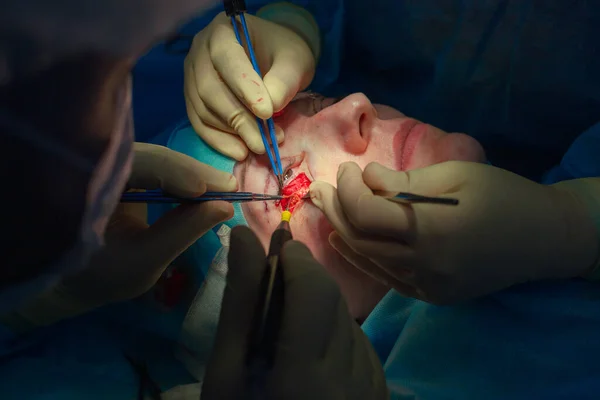 Primer plano de la cara de un paciente que se somete a una blefaroplastia. El cirujano corta el párpado y realiza manipulaciones utilizando instrumentos médicos —  Fotos de Stock