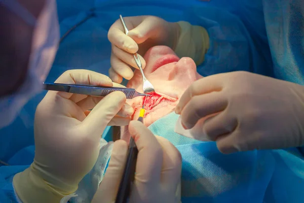 Primer plano de la cara de un paciente que se somete a una blefaroplastia. El cirujano corta el párpado y realiza manipulaciones utilizando instrumentos médicos —  Fotos de Stock