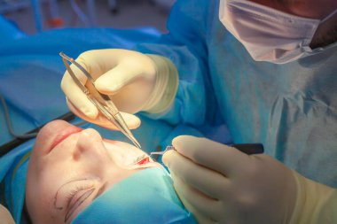 Cerrah, BlePharoplasty ameliyatı sırasında hastanın göz kapağına bir kesik atar. Kapat.