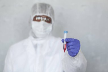 Kimyasal koruma giysisindeki doktor kan örneğini COVID, COVID-19, koronavirüs üzerinde salgını ve salgını durdurmak için test ediyor.