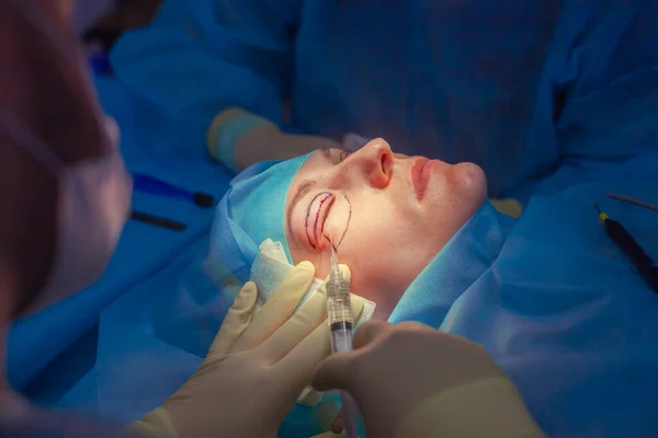 Хірург вставляє ін'єкцію у верхню повіку пацієнта перед виконанням операції з підйому повік. Блефаропластика — стокове фото