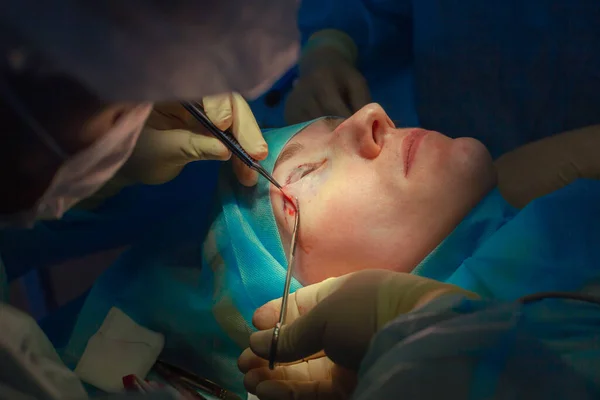 Close up of the face of a patient who is undergoing blepharoplasty. The surgeon cuts the eyelid and performs manipulations using medical instruments