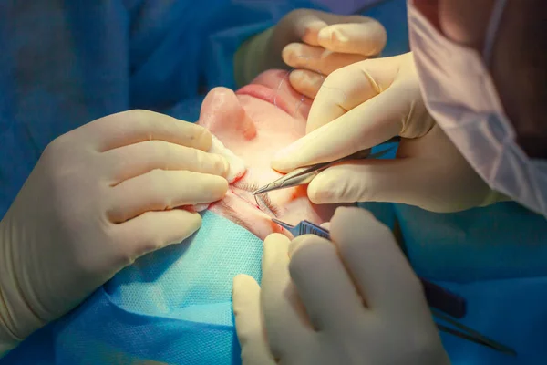 Primer plano de la cara de un paciente que se somete a una blefaroplastia. El cirujano corta el párpado y realiza manipulaciones utilizando instrumentos médicos —  Fotos de Stock