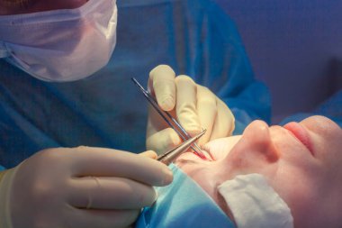 Kan pıhtılaşması geçiren bir hastanın yüzünü kapatın. Cerrah göz kapağını keser ve tıbbi aletlerle manipülasyon yapar.