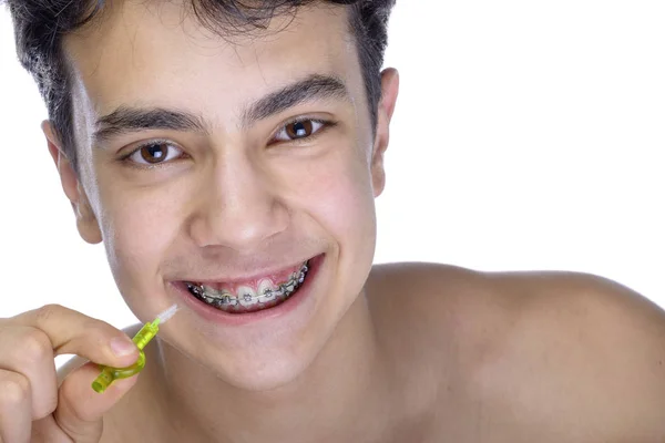 Adolescente chico usando frenos sobre fondo blanco — Foto de Stock