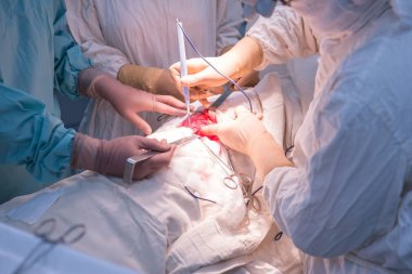 Doktorlar - çocuk cerrahları, steril bir ameliyathanede, böbrek ameliyatı yaparlar.