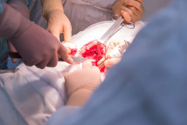 Chirurg z asystentami, w sterylnej sali operacyjnej, jest operowany na organach wewnętrznych. — Zdjęcie stockowe