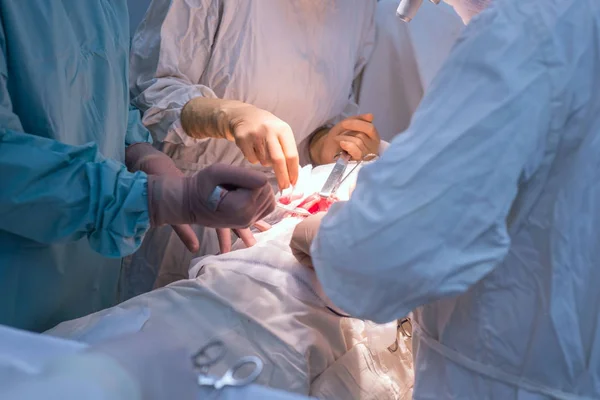 Medici chirurghi pediatrici, in una sala operatoria sterile, eseguono interventi ai reni — Foto Stock