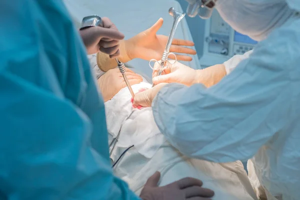 Un chirurgo con assistenti, in una sala operatoria sterile, viene operato su organi interni . — Foto Stock