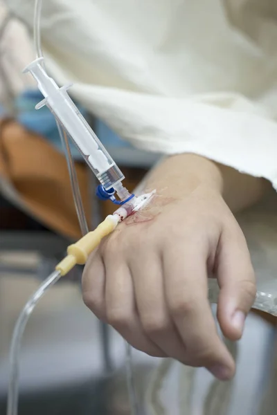 Inyección intravenosa al niño. Mano de un niño con una aguja. Sistema de perfusión intravenosa —  Fotos de Stock